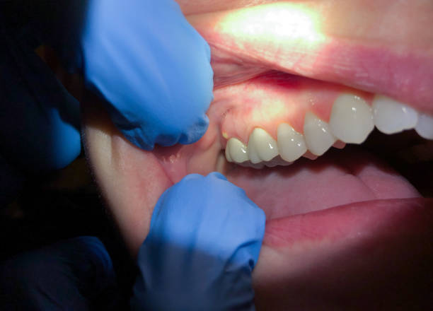 Best Emergency Denture Repair in Loganville, PA
